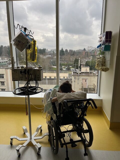 Simon’s double hip osteotomy and the long road to recovery